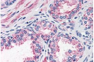 Prostate, Human: Formalin-Fixed, Paraffin-Embedded (FFPE)