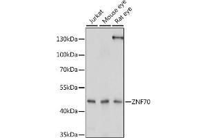 Western blot analysis of extracts of various cell lines, using ZNF70 antibody (ABIN7271522) at 1:1000 dilution. (ZNF70 anticorps  (AA 1-140))