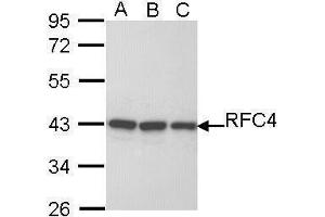 WB Image Sample (30 ug of whole cell lysate) A: H1299 B: Hela C: Hep G2 , 10% SDS PAGE antibody diluted at 1:1000 (RFC4 anticorps)