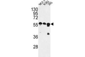 Western Blotting (WB) image for anti-CCR4-NOT Transcription Complex Subunit 4 (CNOT4) antibody (ABIN2998123) (CNOT4 anticorps)