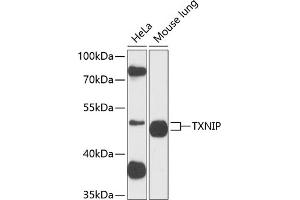 Western blot analysis of extracts of Rat uterus, using TXNIP antibody (ABIN6130776, ABIN6149733, ABIN6149734 and ABIN6224986) at 1:890 dilution. (TXNIP anticorps  (AA 1-166))