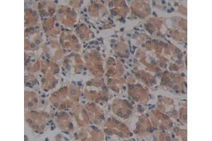 Used in DAB staining on fromalin fixed paraffin- embedded Kidney tissue (CBR1 anticorps  (AA 2-277))