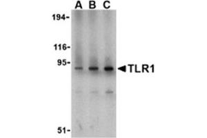 Image no. 1 for anti-Toll-Like Receptor 1 (TLR1) (N-Term) antibody (ABIN318756) (TLR1 anticorps  (N-Term))