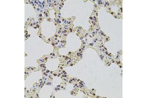 Immunohistochemistry of paraffin-embedded rat lung using HIST1H2AG antibody (ABIN6003627) at dilution of 1/100 (40x lens).