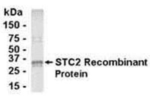 Western Blotting (WB) image for anti-Stanniocalcin 2 (STC2) (AA 20-302) antibody (ABIN2468046) (Stanniocalcin 2 anticorps  (AA 20-302))