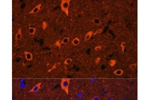 Immunofluorescence analysis of Rat brain using TUBB3 Polyclonal Antibody at dilution of 1:100. (TUBB3 anticorps)
