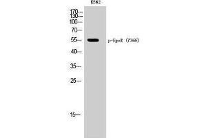 Western Blotting (WB) image for anti-Erythropoietin Receptor (EPOR) (pTyr368) antibody (ABIN3173177) (EPOR anticorps  (pTyr368))