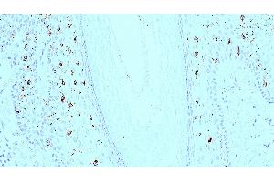 Human skin: immunohistochemical staining for langerin.