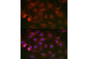 Immunofluorescence analysis of C6 cells using SSR2 Rabbit pAb (ABIN7270299) at dilution of 1:100 (40x lens).
