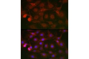 Immunofluorescence analysis of C6 cells using SSR2 Rabbit pAb (ABIN7270299) at dilution of 1:100 (40x lens). (SSR2 anticorps)
