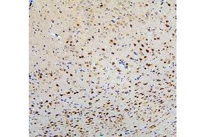IHC analysis of FACL4/ACSL4 using anti-FACL4/ACSL4 antibody (ABIN7602756). (ACSL4 anticorps  (C-Term))