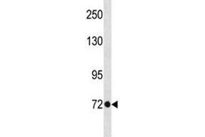 TBR2 antibody western blot analysis in A375 lysate.