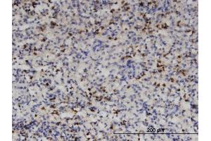 Immunoperoxidase of monoclonal antibody to HDAC4 on formalin-fixed paraffin-embedded human spleen.