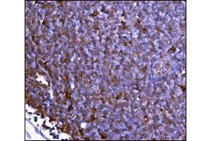 IHC analysis of FABP-1/GOT2 using anti-FABP-1/GOT2 antibody (ABIN7601426). (GOT2 anticorps  (AA 35-430))