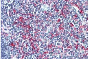 Human Thymus (formalin-fixed, paraffin-embedded) stained with LSP1 antibody ABIN305891 at 1:100 followed by biotinylated goat anti-rabbit IgG secondary antibody ABIN481713, alkaline phosphatase-streptavidin and chromogen. (LSP1 anticorps  (AA 37-48))