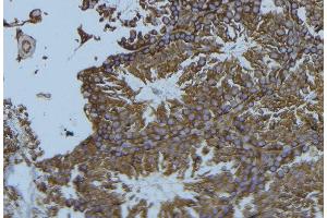 ABIN6276530 at 1/100 staining Mouse testis tissue by IHC-P.