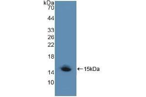 Detection of Recombinant LRP1, Human using Polyclonal Antibody to Low Density Lipoprotein Receptor Related Protein 1 (LRP1) (LRP1 anticorps  (AA 4441-4544))