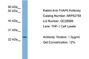 WB Suggested Anti-THAP6  Antibody Titration: 0.