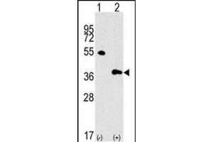 Western blot analysis of GBL Antibody (Center) polyclonal antibody (ABIN392823 and ABIN2842254) (arrow). (GBL anticorps  (AA 140-170))