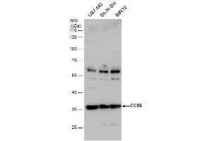 WB Image CCR5 antibody detects CCR5 protein by western blot analysis. (CCR5 anticorps  (Center))