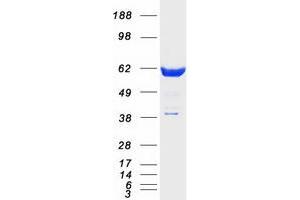 Validation with Western Blot