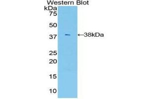 Western Blotting (WB) image for anti-V-Akt Murine Thymoma Viral Oncogene Homolog 3 (Protein Kinase B, Gamma) (AKT3) (AA 46-338) antibody (ABIN1860234) (AKT3 anticorps  (AA 46-338))