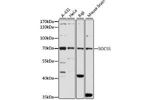 Western blot analysis of extracts of various cell lines, using SOCS5 antibody. (SOCS5 anticorps)