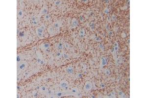 IHC-P analysis of Human Tissue, with DAB staining. (SLC1A6 anticorps  (AA 156-264))