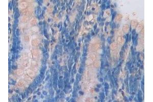 Detection of PANX1 in Rat Intestine Tissue using Polyclonal Antibody to Pannexin 1 (PANX1)