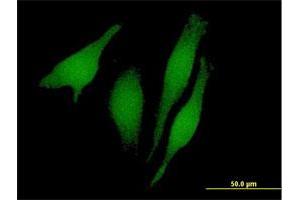 Immunofluorescence of purified MaxPab antibody to RUSC1 on HeLa cell. (RUSC1 anticorps  (AA 1-433))
