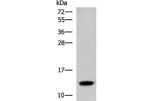 Western blot analysis of Human placenta tissue lysate using HBE1 Polyclonal Antibody at dilution of 1:300 (Hemoglobin, epsilon 1 (HBe1) anticorps)