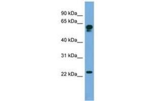 Image no. 1 for anti-Chromosome 14 Open Reading Frame 126 (C14orf126) (AA 71-120) antibody (ABIN6745654) (C14orf126 anticorps  (AA 71-120))