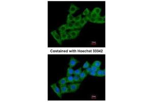 ICC/IF Image Immunofluorescence analysis of methanol-fixed HepG2, using Calcium binding protein P22, antibody at 1:200 dilution. (CHP anticorps  (Internal Region))