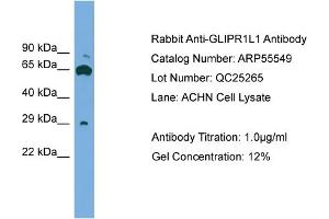 WB Suggested Anti-GLIPR1L1  Antibody Titration: 0. (GLIPR1L1 anticorps  (Middle Region))