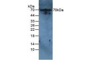 Figure. (IL-6 Receptor anticorps  (AA 385-462))