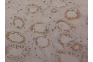 Used in DAB staining on fromalin fixed paraffin-embedded Kidney tissue