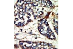 Image no. 1 for anti-NIMA-Related Kinase 1 (NEK1) (AA 1173-1202), (C-Term) antibody (ABIN360536)