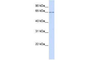 ALG6 antibody used at 1 ug/ml to detect target protein. (ALG6 anticorps)