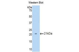 Western Blotting (WB) image for anti-Interleukin 12 Receptor, beta 2 (IL12RB2) (AA 455-606) antibody (ABIN1859337) (IL12RB2 anticorps  (AA 455-606))