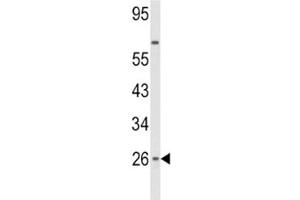 Western blot analysis of IFNB1 antibody and HepG2 lysate.