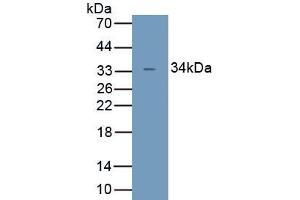 Detection of Recombinant UCP4, Human using Polyclonal Antibody to Uncoupling Protein 4, Mitochondrial (UCP4)