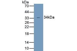 Detection of Recombinant UCP4, Human using Polyclonal Antibody to Uncoupling Protein 4, Mitochondrial (UCP4) (SLC25A27 anticorps  (AA 21-317))