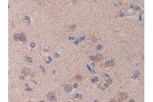 Detection of CTXI in Human Cerebrum Tissue using Monoclonal Antibody to Cross Linked C-Telopeptide Of Type I Collagen (CTXI)