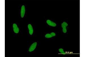 Immunofluorescence of purified MaxPab antibody to ZNF461 on HepG2 cell.