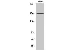 Western Blotting (WB) image for anti-SWI/SNF Related, Matrix Associated, Actin Dependent Regulator of Chromatin, Subfamily C, Member 2 (SMARCC2) (Internal Region) antibody (ABIN3183467)