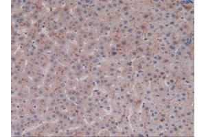 IHC-P analysis of Human Liver Tissue, with DAB staining. (ALT anticorps  (AA 581-738))