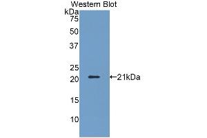 Detection of Recombinant KLRD1, Human using Polyclonal Antibody to Killer Cell Lectin Like Receptor Subfamily D, Member 1 (KLRD1)