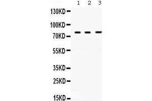 Western Blotting (WB) image for anti-Polymerase (DNA Directed), eta (POLH) (AA 157-361) antibody (ABIN3042492) (POLH anticorps  (AA 157-361))