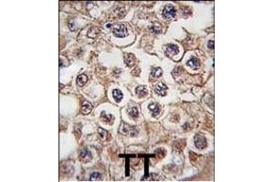 anti-Insulin Receptor (INSR) (AA 27-57), (N-Term) antibody