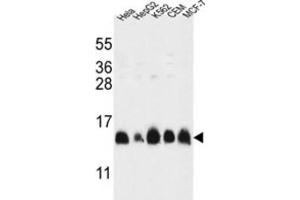 Western Blotting (WB) image for anti-Histone Cluster 1, H2al (HIST1H2AL) antibody (ABIN3002161) (HIST1H2AL anticorps)